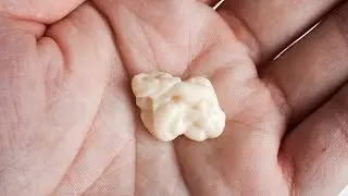 Чем ❌ОПАСНА Жевательная Резинка? 👀Вредно ли Жевать ЖВАЧКУ?