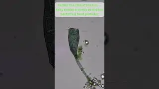 Stentor #shorts  #microscope #science #microscope #biology #nature #motic