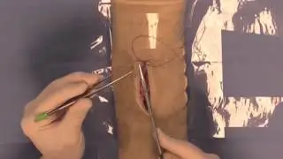 Simple Continuous Suture Pattern