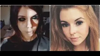 Модель ослепла после татуажа
