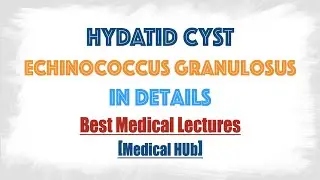 Hydatid cyst of Echinococcus granulosus(Dog tapeworm) : Discussed in details everything you need