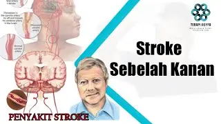 Right Hand and Foot Stroke Therapy