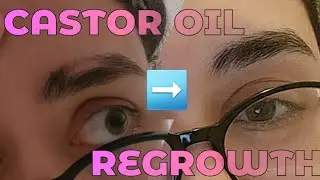 I REGREW MY BURNT EYEBROW USING CASTOR OIL