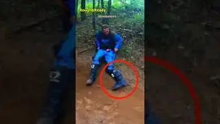 Dirt Biker's Prosthetic Leg Comes Off in Crash