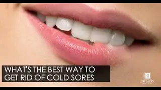 How Can I Treat Cold Sores - Cold Sore Laser Treatments