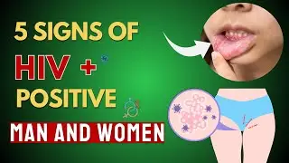 WARNING SIGNS ! 5 Symptoms of HIV in WOMAN and MAN #hiv