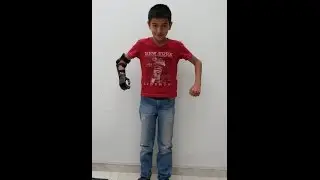 e-NABLE flexy arm