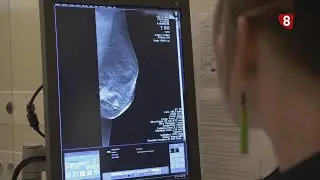 Cáncer de mama en jóvenes