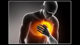 Approach to chest pain!