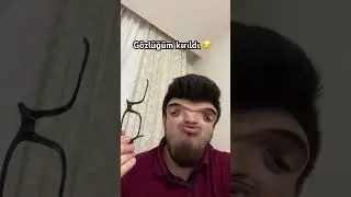 Gözlüğüm kırıldı 😔