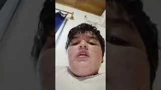 xd