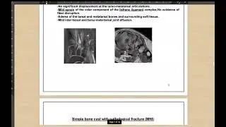 lecture 19 part 2