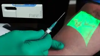 Vein Finder for Patient Comfort - Finding Veins is Easy! 🔎