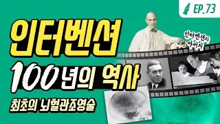 수술없는 치료의 시작, 인터벤션 영상의학100년의 역사