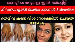കറുപ്പിനെ തുടച്ചു മാറ്റാം ഞെട്ടിക്കുന്ന റിസൾട്ട്‌ 😱/Permanent skin whitening#viral