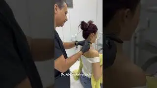 Shoulder muscular Botox #spasm #shoulderbotox #botoxinjection