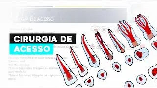 Cirurgia de Acesso Endodôntico: Guia Completo para Dentistas Iniciantes