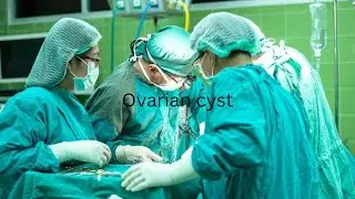 S9E3 All you need to know about Ovarian Cyst