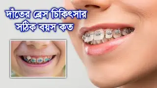 দাঁতের ব্রেস চিকিৎসার সঠিক বয়স কত Braces Treatment @DentalHealthTips