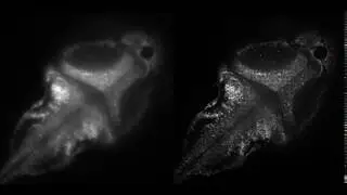 Spontaneous activity in the zebrafish brain
