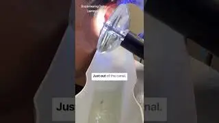 Felt “clogged” in ears after scuba diving.  Found out why..