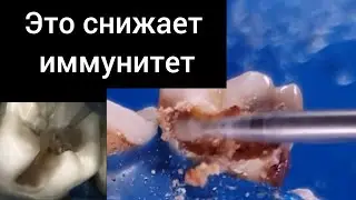 Это снижает иммунитет!