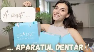 Mi-am pus SPARK ALIGNERS !! Cel mai emotionant video cu aparatul dentar🥹
