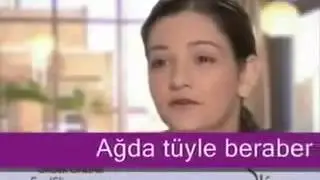 Yüz Tüy Alma Aleti Slique