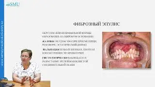 ПАРОДОНТОМЫ
