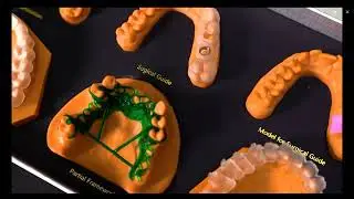 Focus 6K: One machine matching a variety of dental medical applications