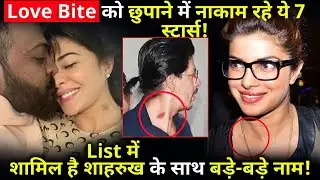 7 Bollywood celebs could not hide their love bite !