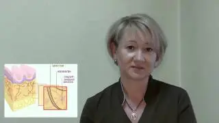 Вся правда про гиалуроновую кислоту. Елена Хлопова.