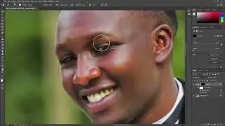 SKIN RETOUCH USING HIGHPASS ADOBE PHOTOSHOP