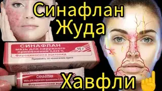 Энг хавфли маз синафлан хакида билармидингиз? Sinaflan mazi xavfi  xaqida ochiqchasiga aytildi