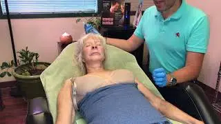 Sculptra for the décolleté