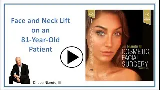 81 Year Old after Face and Neck Lift  