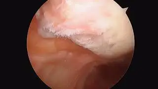 L Knee Biocartilage 7 18 19 SK