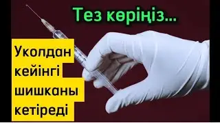 УКОЛДАН кейінгі ШИШКАНЫ ОСЫЛАЙ ЕМДЕҢІЗ. Екпеден кейінгі түйінді кетіру әдістері. Денсаулық арнасы