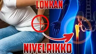 Lonkan nivelrikko - yleisyys, tyypillinen oirekuva ja hyvät harjoitteet hoitoon