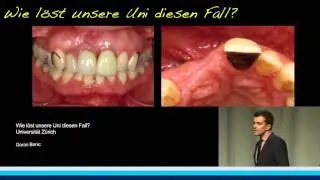 Fallvorstellung der Universitäten ZH, GE, BE, BS| G. Benic , V. Chappuis , A. Worni , D. Mahl