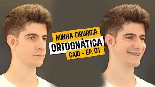 Cirurgia Ortognática - Microssomia Hemifacial - EP. 01