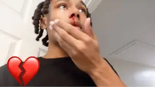 YANNI 🅿️UNCHED ME IN MY FACE FOR STRESSING HER OUT *MY NOSE STARTED 🅱️LEEDING💔* 