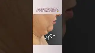 Как убрать второй подбородок?