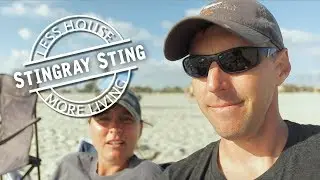 Stung By a Stingray!
