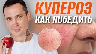 КУПЕРОЗ как победить | Полное пособие 