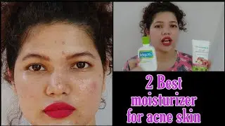 2 Best Moisturizer For Acne / Pimple Skin  / IamManisha