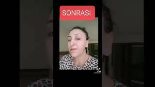 leke kremi setimizden gelen memnuniyet videosu