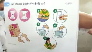 Sign of diarrhoea and its management