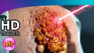 CYST Teaser Trailer 2020
