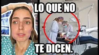 ME QUITARON LAS MUELAS DEL JUICIO ¿DUELE MUCHO?